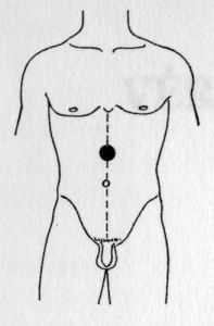 gastritis akupresszúra pont