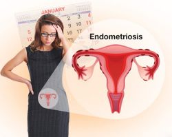 rendszertelen menstruáció