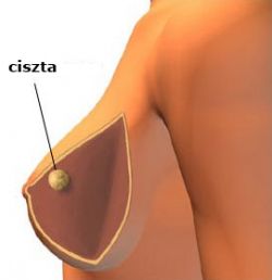 mell ciszta