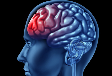 Alzheimer betegség