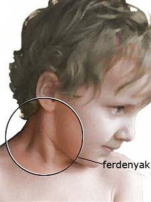 ferdenyak