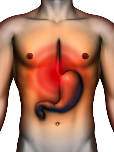 gyomorhurut gastritis