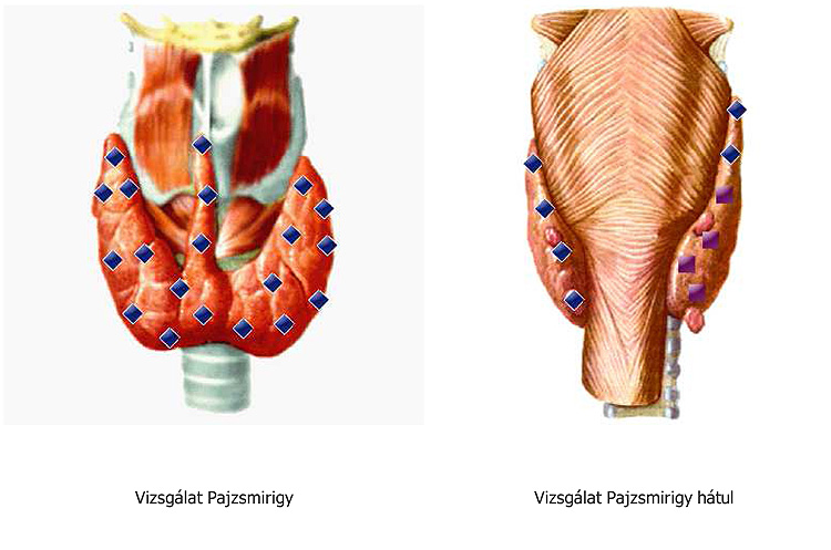 pajzsmirigy vizsgálat