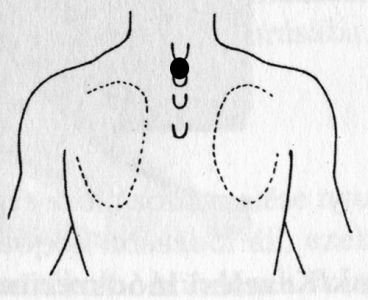 bronchitis akupresszúra pont