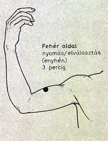 köhögés akupresszúra pontok