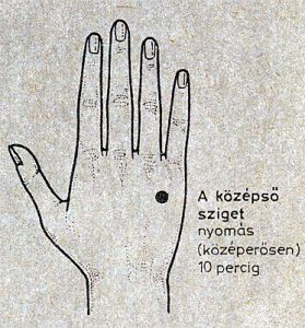 migrén akupresszúra kezelése