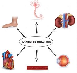 cukorbetegség diabetes mellitus