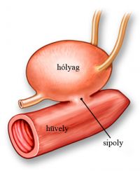 hólyag sipoly