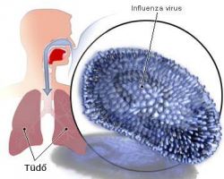 influenza