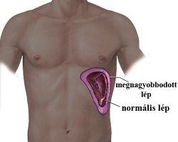 lépmegnagyobbodás