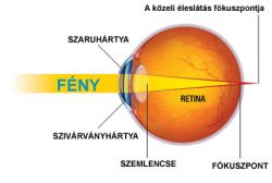 Távollátás