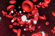 vérszegénység anemia